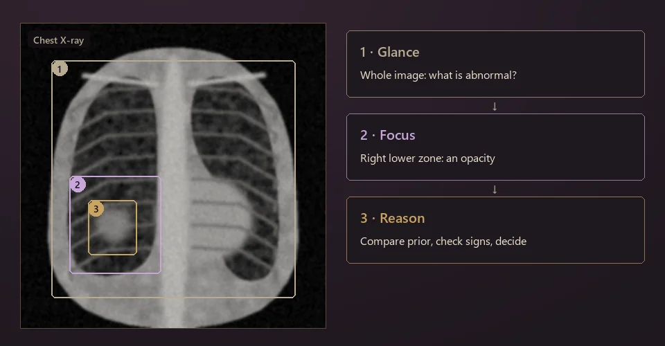 Illustration: chest X-ray with three nested boxes for glance, focus and reason, beside three steps describing an expert's reading process.