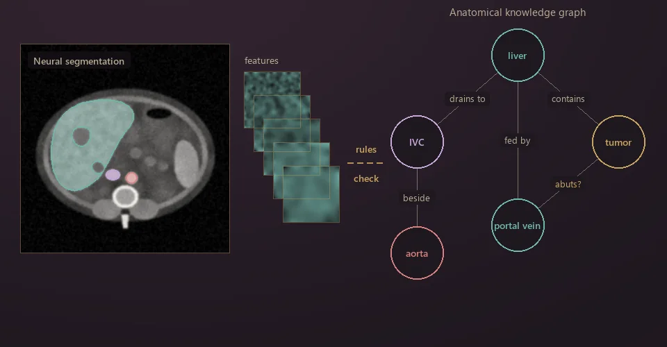 Illustration: a neural segmentation of abdominal CT and its feature maps, checked against a knowledge graph of anatomical relations such as liver, IVC, aorta, portal vein and tumor.