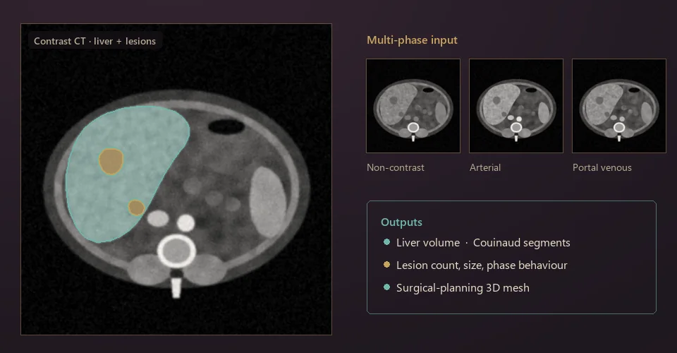 Illustration: abdominal CT slice with the liver outlined in teal and two lesions in gold, beside three contrast-phase thumbnails and a list of outputs.